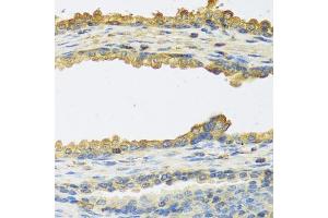 Immunohistochemistry of paraffin-embedded human prostate using TSHB antibody (ABIN6132751, ABIN6149620, ABIN6149621 and ABIN6222522) at dilution of 1:100 (40x lens). (TSHB 抗体  (AA 21-138))
