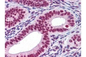 Immunohistochemistry (IHC) image for anti-Runt-Related Transcription Factor 2 (RUNX2) (AA 251-351) antibody (ABIN614586) (RUNX2 抗体  (AA 251-351))