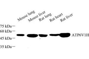 Western blot analysis of ATP6V1H (ABIN7073158) at dilution of 1: 500