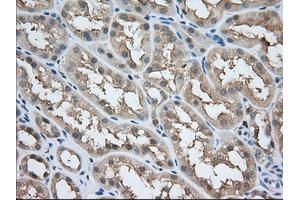 Image no. 4 for anti-Acetyl-CoA Acetyltransferase 2 (ACAT2) antibody (ABIN1496401) (ACAT2 抗体)