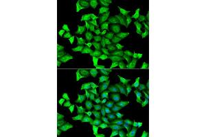 Immunofluorescence analysis of HeLa cell using SEPSECS antibody. (SEPSECS 抗体)