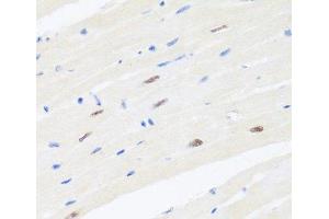 Immunohistochemistry of paraffin-embedded Mouse heart using BRMS1 Polyclonal Antibody at dilution of 1:100 (40x lens). (BRMS1 抗体)