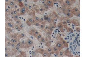 Detection of NEIL1 in Human Liver Tissue using Polyclonal Antibody to Nei Endonuclease VIII Like Protein 1 (NEIL1) (NEIL1 抗体  (AA 43-314))