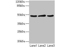 Western blot All lanes: Serpinb2 antibody at 2 μg/mL Lane 1: MCF-7 whole cell lysate Lane 2: 293T whole cell lysate Lane 3: Rat liver tissue Secondary Goat polyclonal to rabbit IgG at 1/10000 dilution Predicted band size: 48 kDa Observed band size: 48 kDa (SERPINB2 抗体  (AA 1-416))