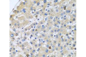 Immunohistochemistry of paraffin-embedded Human liver using APOA5 Polyclonal Antibody at dilution of 1:100 (40x lens). (APOA5 抗体)