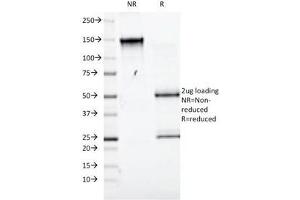 SDS-PAGE (SDS) image for anti-Solute Carrier Family 3 (Activators of Dibasic and Neutral Amino Acid Transport), Member 2 (SLC3A2) antibody (ABIN3024509)