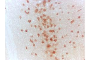 Immunohistochemistry (IHC) image for anti-Wingless-Type MMTV Integration Site Family, Member 5A (WNT5A) (AA 301-381) antibody (ABIN675758)