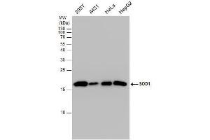 Western Blotting (WB) image for anti-Superoxide Dismutase 1, Soluble (SOD1) (C-Term) antibody (ABIN2854826)