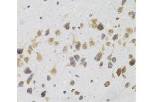 Immunohistochemistry of paraffin-embedded Mouse brain using FLT3 Polyclonal Antibody (FLT3 抗体)