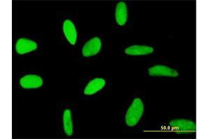 Immunofluorescence of purified MaxPab antibody to RECQL on HeLa cell. (RecQ Protein-Like (DNA Helicase Q1-Like) (RECQL) (AA 1-649) 抗体)