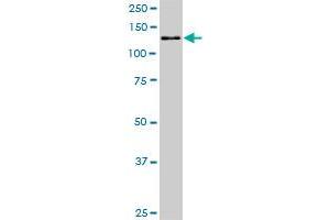 Western Blotting (WB) image for anti-Cullin-Associated and Neddylation-Dissociated 1 (CAND1) (AA 1-100) antibody (ABIN527716)