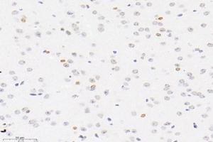 Immunohistochemistry analysis of paraffin-embedded mouse brain using,PLK5 (ABIN7075111) at dilution of 1: 4000 (PLK5 抗体)
