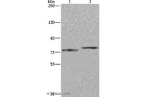 Western blot analysis of Mouse heart tissue and 231 cell, using AATF Polyclonal Antibody at dilution of 1:667 (AATF 抗体)