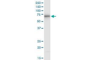 ATE1 monoclonal antibody (M01), clone 2B6. (ATE1 抗体  (AA 1-87))