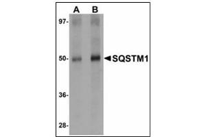 Western blot analysis of SQSTM1 in Human spleen tissue lysate with SQSTM1 antibody at (A) 1 and (B) 2 µg/ml. (SQSTM1 抗体  (C-Term))