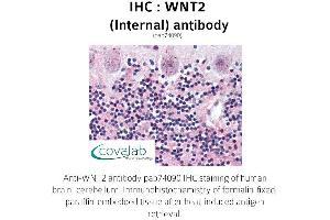 Image no. 1 for anti-Wingless-Type MMTV Integration Site Family Member 2 (WNT2) (Internal Region) antibody (ABIN1740825) (WNT2 抗体  (Internal Region))