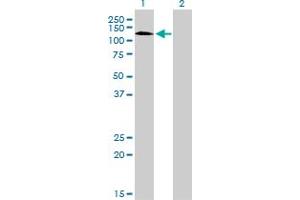 Western Blot analysis of RNF111 expression in transfected 293T cell line by RNF111 monoclonal antibody (M05), clone 1C4.