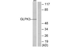 Western blot analysis of extracts from 293 cells, using GLPK3 antibody. (Glycerol Kinase 抗体  (N-Term))