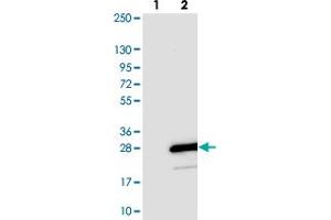Western blot analysis of Lane 1: Negative control (vector only transfected HEK293T lysate). (TOMM20L 抗体)
