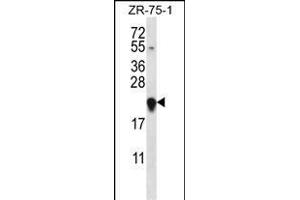 GAGE12H Antibody (N-term) (ABIN657560 and ABIN2846567) western blot analysis in ZR-75-1 cell line lysates (35 μg/lane). (G Antigen 12H 抗体  (N-Term))