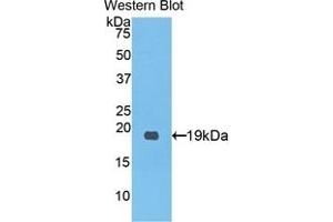 Detection of Recombinant PCPE1, Human using Polyclonal Antibody to Procollagen C-Endopeptidase Enhancer (PCOLCE) (PCOLCE 抗体  (AA 315-437))