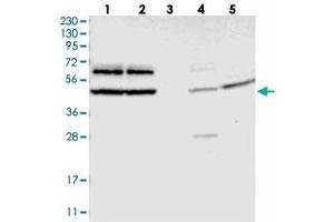 Western blot analysis of Lane 1: RT-4, Lane 2: U-251 MG, Lane 3: Human Plasma, Lane 4: Liver, Lane 5: Tonsil with G3BP2 polyclonal antibody  at 1:250-1:500 dilution. (G3BP2 抗体)