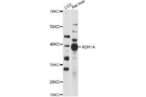 Western blot analysis of extracts of various cell lines, using ADH1A antibody (ABIN6292633) at 1:1000 dilution.