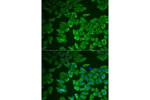Immunofluorescence (IF) image for anti-Corticotropin Releasing Hormone Binding Protein (CRHBP) (AA 25-322) antibody (ABIN6139030)