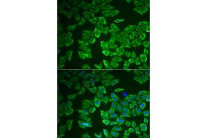 Immunofluorescence analysis of HeLa cells using CRHBP antibody (ABIN6129571, ABIN6139030, ABIN6139033 and ABIN6222243). (CRHBP 抗体  (AA 25-322))