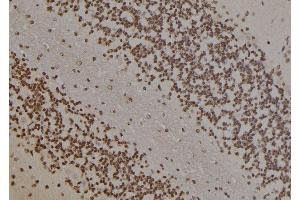 ABIN6277453 at 1/100 staining Rat brain tissue by IHC-P. (PARP1 抗体  (Internal Region))