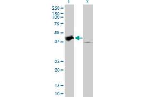 Western Blotting (WB) image for anti-Tribbles Pseudokinase 2 (TRIB2) (AA 254-344) antibody (ABIN599226) (TRIB2 抗体  (AA 254-344))