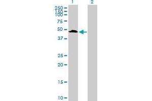 Western Blot analysis of UIMC1 expression in transfected 293T cell line by UIMC1 MaxPab polyclonal antibody. (UIMC1 抗体  (AA 1-385))