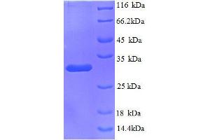 Kininogen 1 (KNG1) (AA 390-644) protein (His tag) (KNG1 Protein (AA 390-644) (His tag))