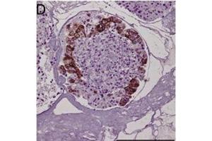 Immunohistochemical staining of tumor biopsy and biopsy spheroid sections.