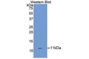 Western Blotting (WB) image for anti-Solute Carrier Family 6 (Neurotransmitter Transporter, Dopamine), Member 3 (SLC6A3) (AA 562-619) antibody (ABIN1867519) (SLC6A3 抗体  (AA 562-619))