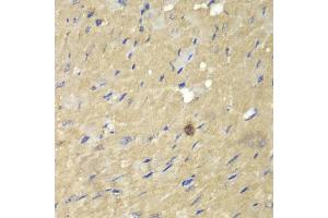 Immunohistochemistry of paraffin-embedded mouse heart using AKR7A2 antibody (ABIN5970569) at dilution of 1/100 (40x lens). (AKR7A2 抗体)