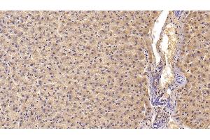 Immunohistochemistry (IHC) image for anti-Haptoglobin (HP) (AA 123-307) antibody (ABIN7432676)