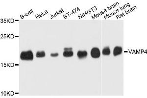 Western blot analysis of extract of various cells, using VAMP4 antibody. (VAMP4 抗体)