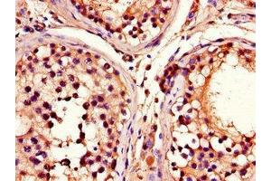Immunohistochemistry of paraffin-embedded human testis tissue using ABIN7164909 at dilution of 1:100 (ADRM1 抗体  (AA 2-407))