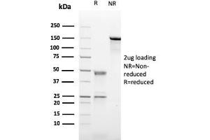 SDS-PAGE Analysis Purified CD21-Monospecific Mouse Monoclonal Antibody (CR2/2754). (CD21 抗体  (AA 142-240))