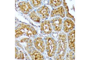 Immunohistochemistry of paraffin-embedded rat kidney using  Rabbit mAb (ABIN7265369) at dilution of 1:100 (40x lens). (Acetyl-CoA Carboxylase alpha 抗体)