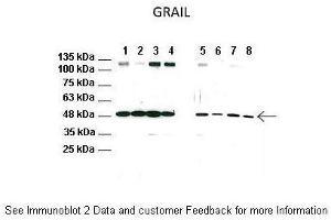 Lanes:   1: CD4 T cell lysate from WT mice, 2: CD4 T cell lysate from WT mice treated with anti-CD3/CD28, 3: CD4 T cell lysate from WT mice treated with FK506, 4: CD4 T cell lysate from WT mice treated with anti-CD3/CD28 and FK506, 5: CD4 T cell lysate from TRPV1 KO mice, 6: CD4 T cell lysate from TRPV1 KO mice treated with anti-CD3/CD28, 7: CD4 T cell lysate from TRPV1 KO mice treated with FK506, 8: CD4 T cell lysate from TRPV1 KO mice treated with anti-CD3/CD28 and FK506. (RNF128 抗体  (C-Term))