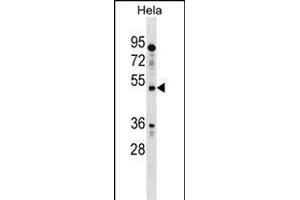 IL13RA1 Antibody (N-term) (ABIN1539471 and ABIN2848825) western blot analysis in Hela cell line lysates (35 μg/lane). (IL13 Receptor alpha 1 抗体  (N-Term))
