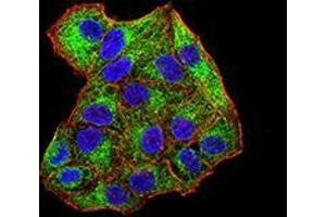 Immunofluorescence analysis of Hela cells using SYK mouse mAb (green). (SYK 抗体  (AA 217-356))