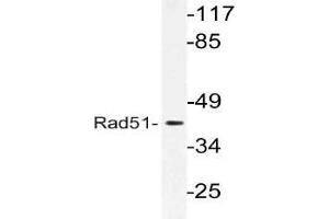 Western blot (WB) analysis of Rad51 antibody in extracts from LOVO cells. (RAD51 抗体)