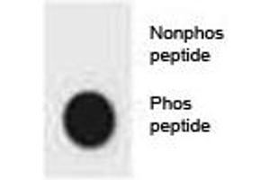 Dot blot analysis of phospho-CDKN2A antibody. (CDKN2A 抗体  (pSer8))