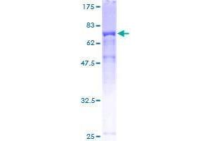 TTC38 Protein (AA 1-469) (GST tag)