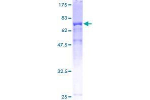 TTC38 Protein (AA 1-469) (GST tag)