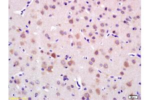 Formalin-fixed and paraffin embedded rat brain labeled with Anti-LRIG1 Polyclonal Antibody, Unconjugated (ABIN735263) at 1:200 followed by conjugation to the secondary antibody and DAB staining. (Lrig1 抗体  (AA 1001-1093))