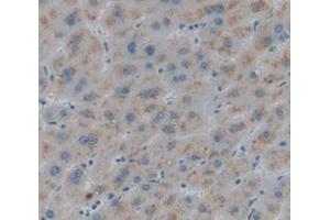 IHC-P analysis of Human Tissue, with DAB staining. (GBA 抗体  (AA 334-498))